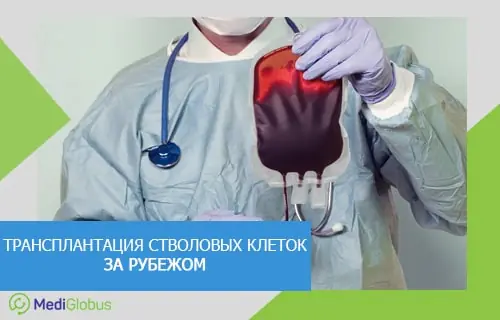 как проводится пересадка костного мозга при саркоме Юинга у детей Лечение саркомы Юинга у детей
