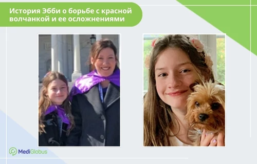 Лечение осложнений при красной волчанке