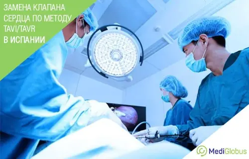 Испания - ТАВИ звмена клапана сердца хирурги проводят транскатетерную замену клапана сердца и смотрят на монитор