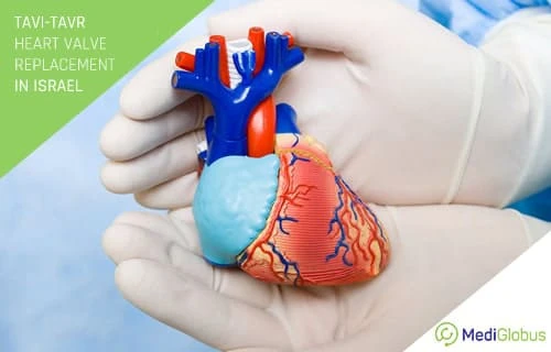 tavie heart valve replacement surgery israel