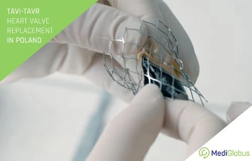 tavie heart valve replacement surgery poland