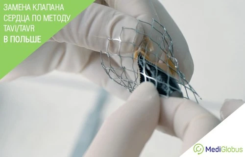 Замена клапана сердца ТАВИ в Польше Врач в перчатках держит металлический каркас транскатетерного аортального клапана для процедуры TAVI/TAVR