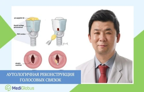 Инновационный метод восстановления голоса в зарубежных клиниках Врач в белом халате на фоне медицинских схем, показывающих этапы реконструкции голосовых связок; слева подпись: "Аутологичная реконструкция голосовых связок"