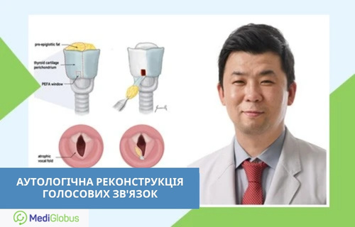 Інноваційний метод відновлення голосу в закордонних клініках Лікар у білому халаті на тлі медичних схем, що ілюструють етапи реконструкції голосових зв’язок; ліворуч підпис: «Аутологічна реконструкція голосових зв’язок»
