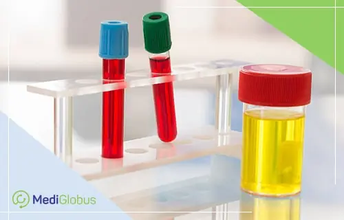 How multiple myeloma is diagnosed abroad