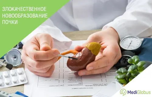 врач показывает анатомическую модель почки на консультации по заболеванию