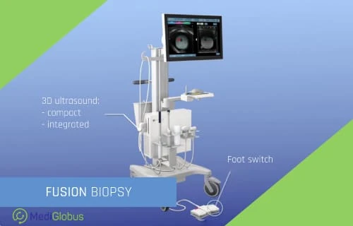 prostate cancer diagnostic abroad fusion biopsy