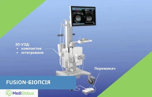 Фьюжн-біопсія простати: обладнання з 3D-УЗД та навігацією для точного виконання процедури Апарат для фьюжн-біопсії з екраном, 3D-УЗД та панеллю керування