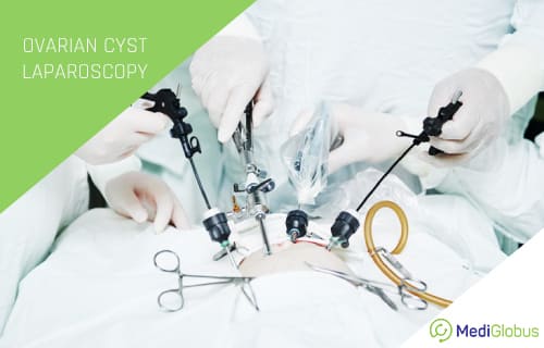laparoscopic surgery treatment for ovarian cysts