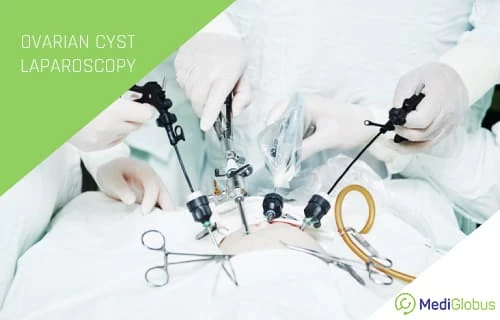 laparoscopic surgery treatment for ovarian cysts