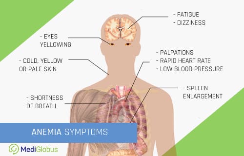 symptoms of aplastic anemia