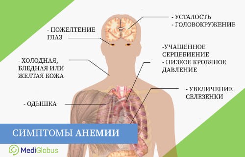 Симптомы и причины анемии