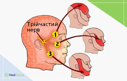 невралгія трійчастого нерва схема трійчастого нерва з трьома гілками та зонами болю на обличчі