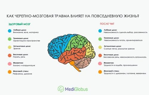 Повреждения мозга при ЧМТ Инфографика: Какие функции мозга теряются после черепно-мозговой травмы