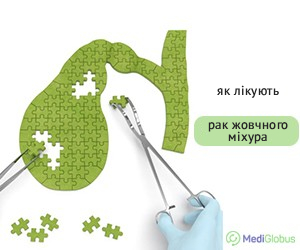 gallbladder_cancer_treatment_ukr Як лікують рак жовчного міхура?