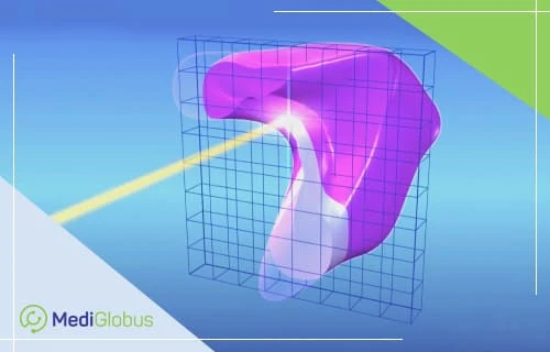 сканирование карандашным пучком 3D‑изображение органа, созданное для настройки протонной терапии; показан объёмный анатомический объект в сетчатой координатной системе, через который проходит направленный луч для точного планирования облучения.