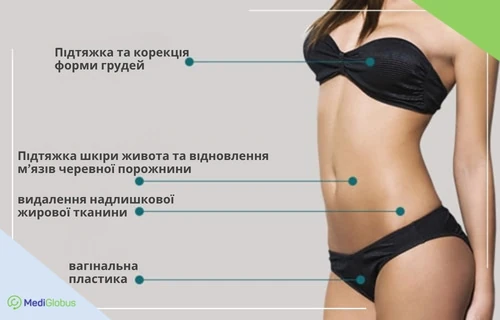 Інфографіка: Що входить до комплексу пластичних процедур Mommy makeover