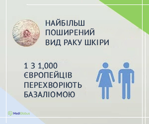 basal_cancer_stats_ukr Статистика поширеності базаліоми