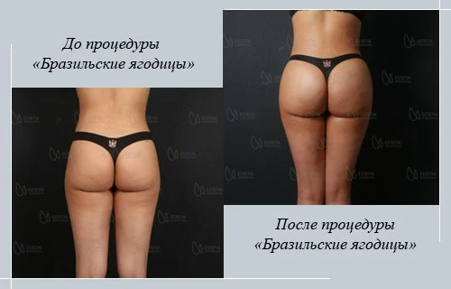 Клиника Эстетик Интернешл Бурса