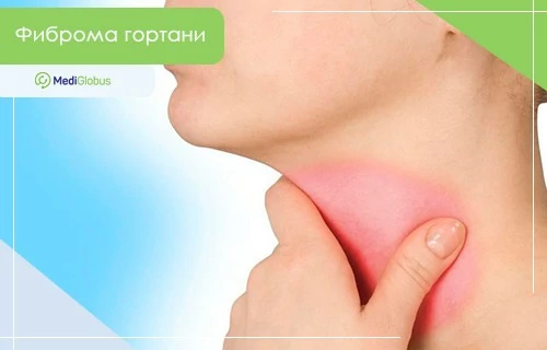 Фиброма гортани Женщина держит руку на шее, область гортани выделена красным цветом, символизирующим воспаление или дискомфорт