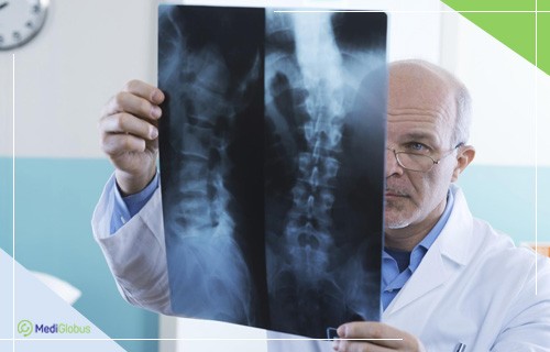 рентген при остеобластоме