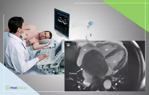 Діагностика ангіосаркоми серця Ліворуч — процедура проведення УЗД серця; праворуч — знімок серця з позначенням ділянки ураження