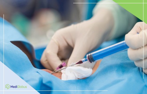 медичний фахівець виконує введення голки шприца в шкіру пацієнта. Рука лікаря в стерильній рукавичці тримає інструмент, а місце проколу прикрите стерильною серветкою та операційним покриттям.