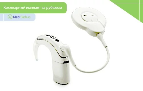 Белый кохлеарный имплант, состоящий из внешнего звукового процессора и круглого передатчика, соединенных кабелем