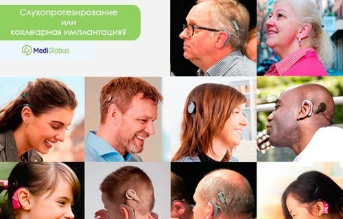 коллаж из фотографий различных людей со слуховыми аппаратами