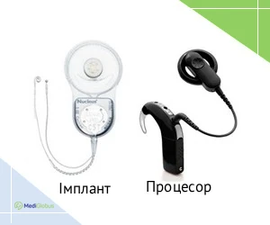 hearing_implant_processor_ukr Кохлеарний імплант vs кохлеарний процесор
