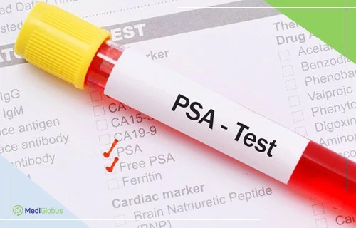 Навіщо потрібен і як проводять PSA тест при раку простати?