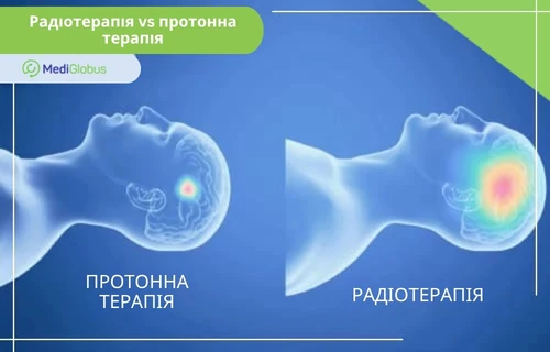 порівняння протонної терапії та стандартного опромінення Візуалізація впливу опромінення на пухлину та навколишні тканини головного мозку: ліворуч — протонна терапія, праворуч — радіотерапія