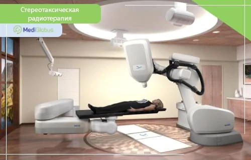 Виды дистанционной лучевой терапии: Стереотаксическая радиотерапия (SRS/SRT) Пациент проходит стереотаксическую радиотерапию на роботизированной установке