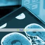 Обзор 4 перспективных методов для лечения рака головного мозга