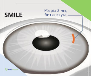 smile_surgery_ukr Як виглядає SMILE операція на очах