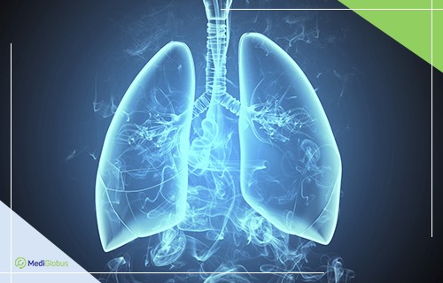 Рак лёгких 3 стадия. Диагностика, лечение и прогноз