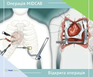 midcab_vs_open_ukr Порівняння MIDCAB з відкритою операцією на серці