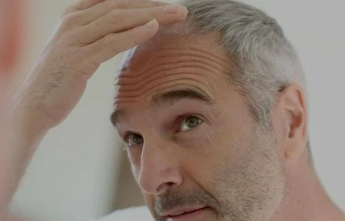 Клініка Turkey Hair Academy
