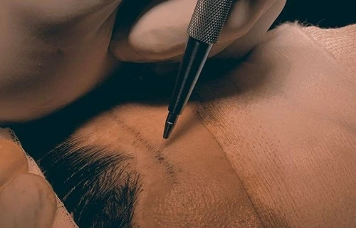Клініка Turkey Hair Academy