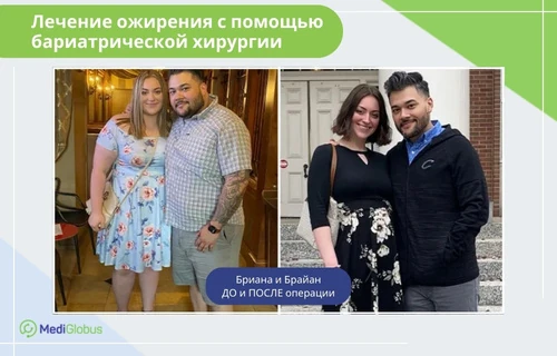 хирургия для лечения ожирения