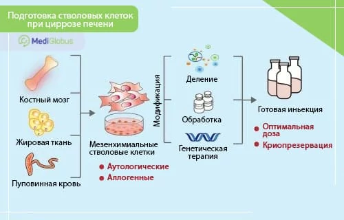 Стволовые клетки при циррозе печени На инфографике показан процесс подготовки мезенхимальных стволовых клеток (МСК) для лечения цирроза печени.
