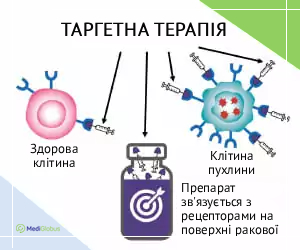targeted_therapy_info_ukr Як працює таргетна терапія схема