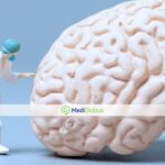 лечение метастазов в головном мозге за границей