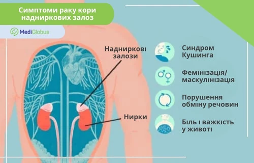 симптоми раку надниркових залоз схематичне зображення внутрішніх органів із виділеними нирками та наднирковими залозами, а також симптомами раку кори надниркових залоз