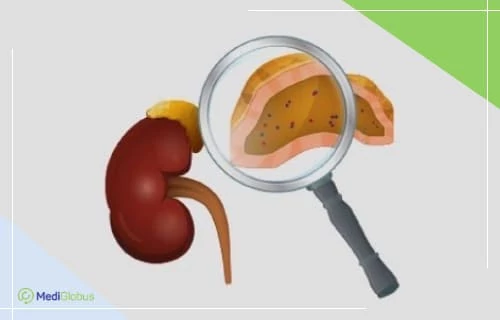 adrenal gland neoplasm