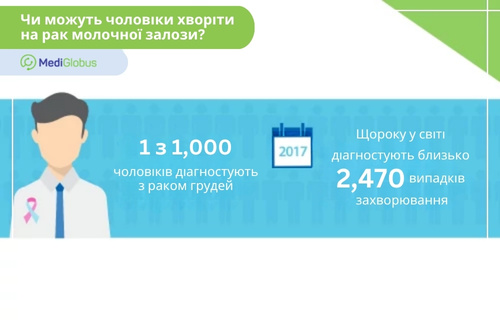 Статистика захворюваності на рак молочної залози у чоловіків Інфографіка про рак молочної залози у чоловіків