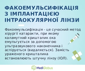 phacoemulsification_info_ukr Інформація про проведення заміни кришталика ока за кордоном