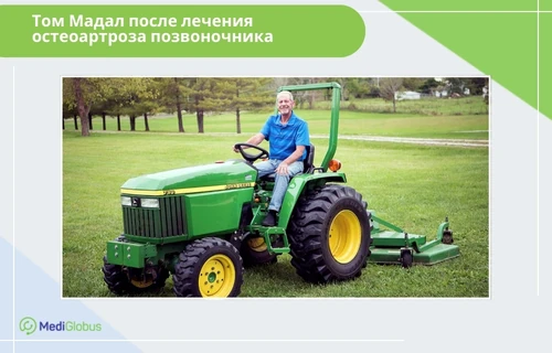 отзывы о лечении остеоартроза позвоночника