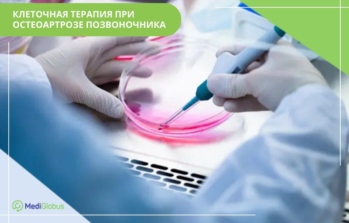 стволовые клетки при остеоартрозе позвоночника