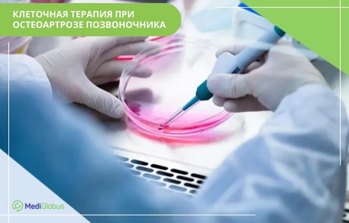 стволовые клетки при остеоартрозе позвоночника